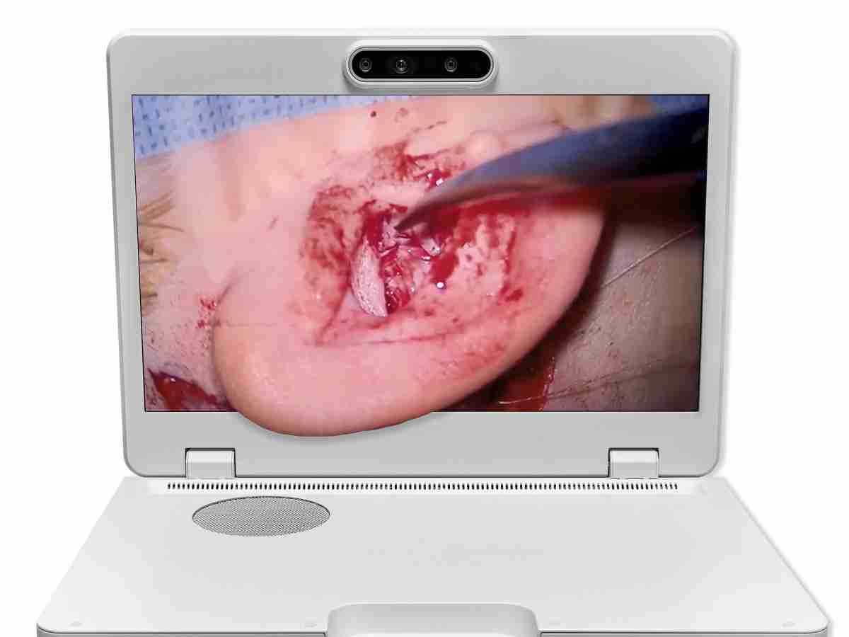 达擎之＂Heads-up 3D显微手术显示系统＂，，，整合4K裸眼3D显示及眼球追踪系统，，，具备快速追踪人眼移动位置功能，，减轻医师长时间维持固定姿势的负担，，，让医师能有更宽广清晰的3D立体视野及更舒适的姿势来执行手术。。。